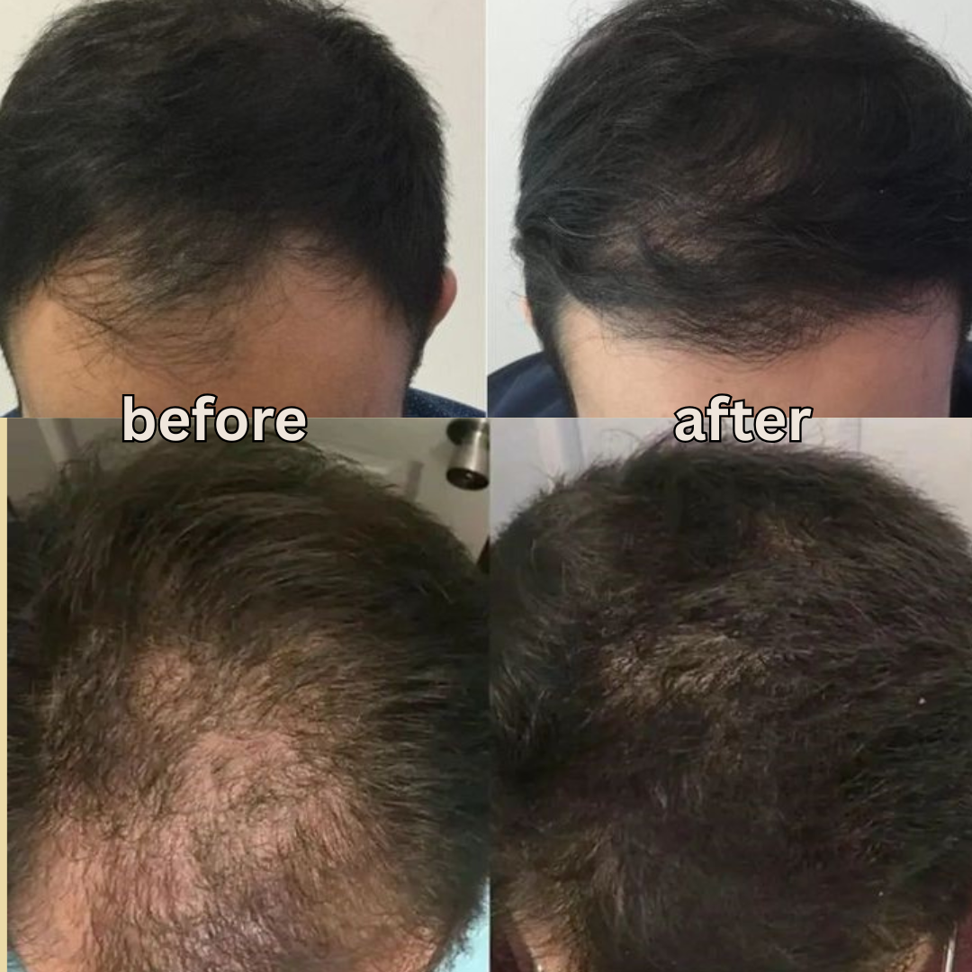 EZZA BLOOM HERBAL HAIR OIL