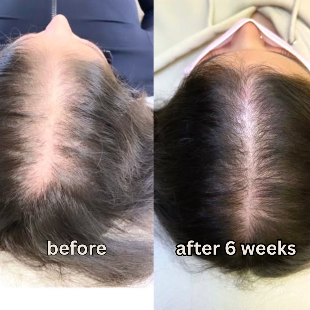 EZZA BLOOM HERBAL HAIR OIL